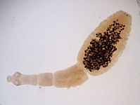Echinococus